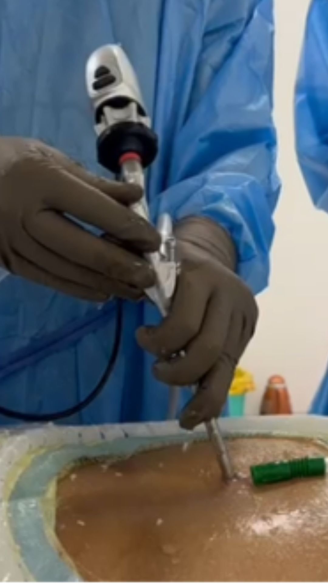 Endoscopic spine surgery technique