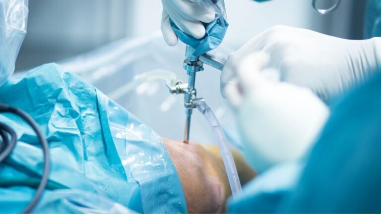 Arthroscopic PCL reconstruction