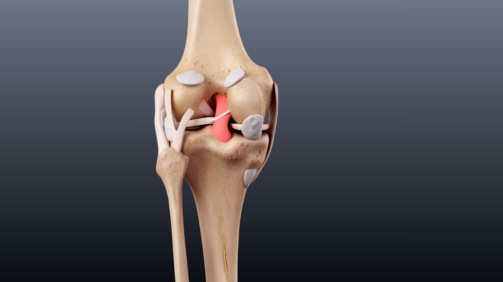 Posterior cruciate ligament injury