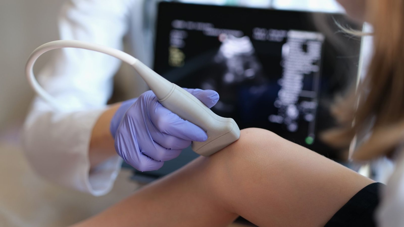 Ultrasound guided knee viscosupplementation injection