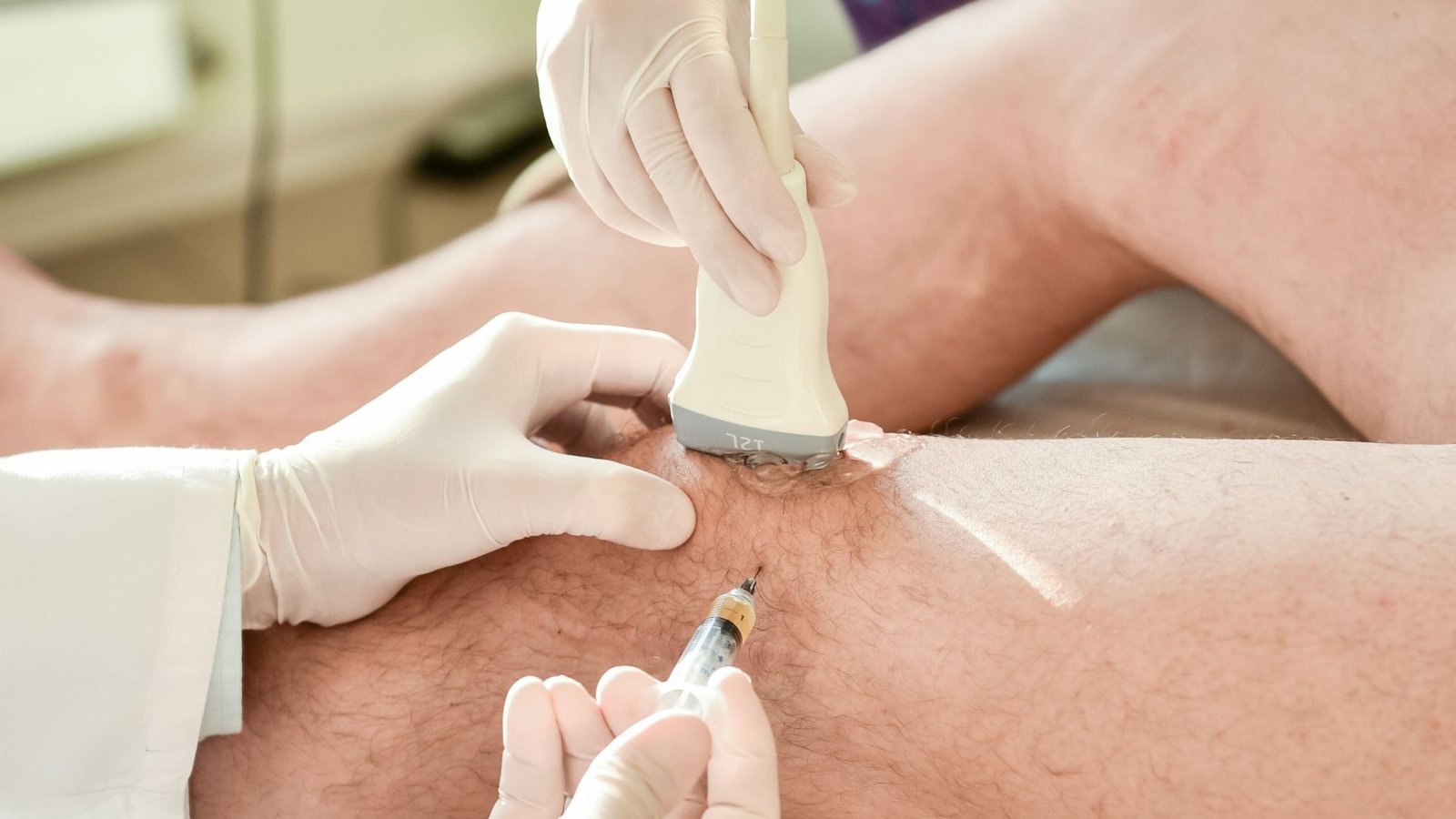 Ultrasound guided knee steroid injection